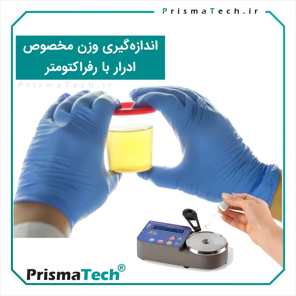 اندازه گیری وزن ادرار با رفرکتومتر پریسماتک